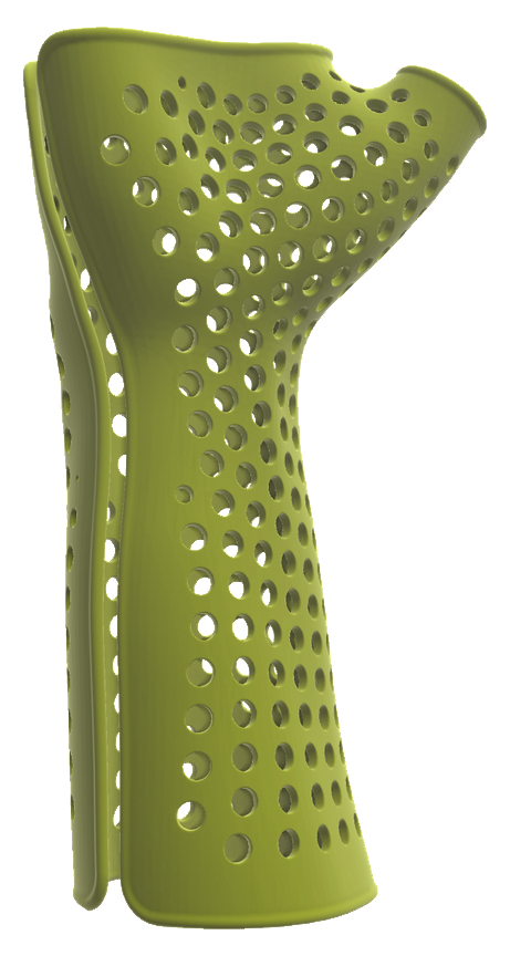 The brace demo's result: a ventilated wrist brace built on an arm scan, its hole pattern laid on a quad grid